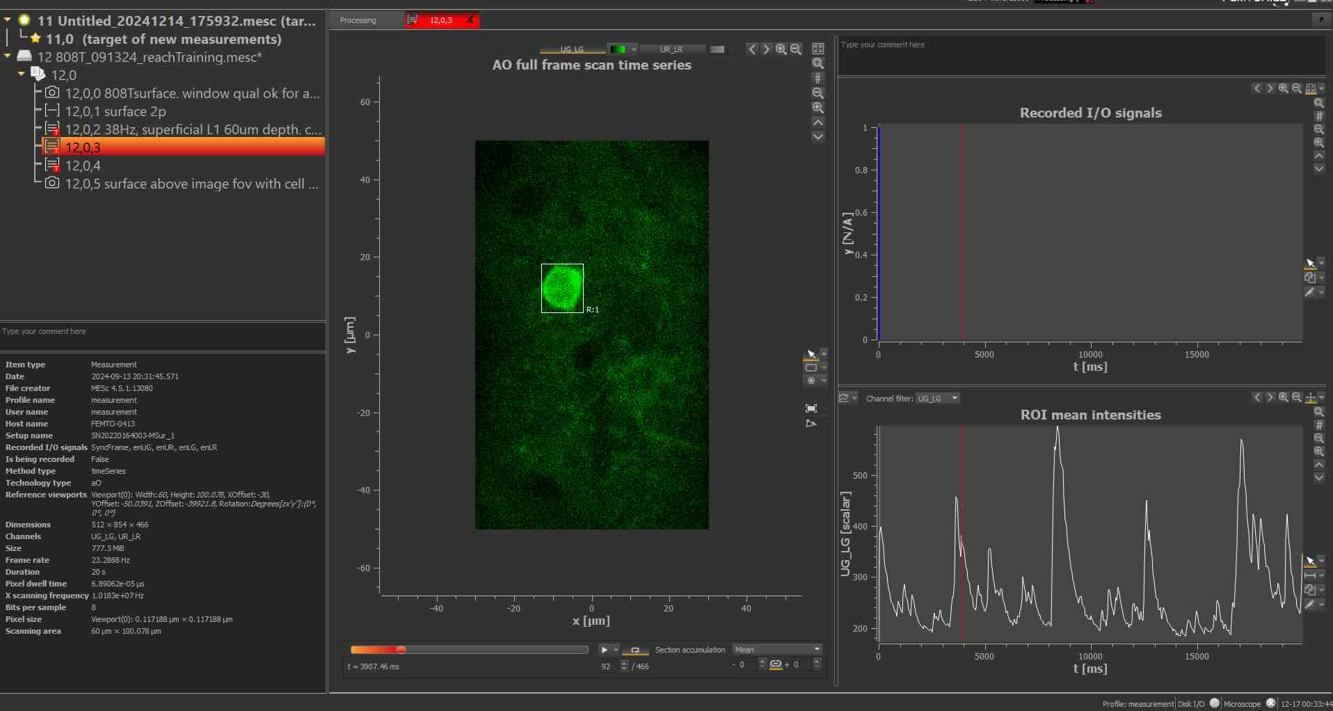  Post acquisition view of a single cell (in the square) and its calcium activity trace (bottom right)