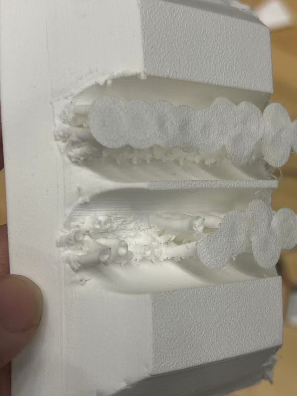 Difficult support removal