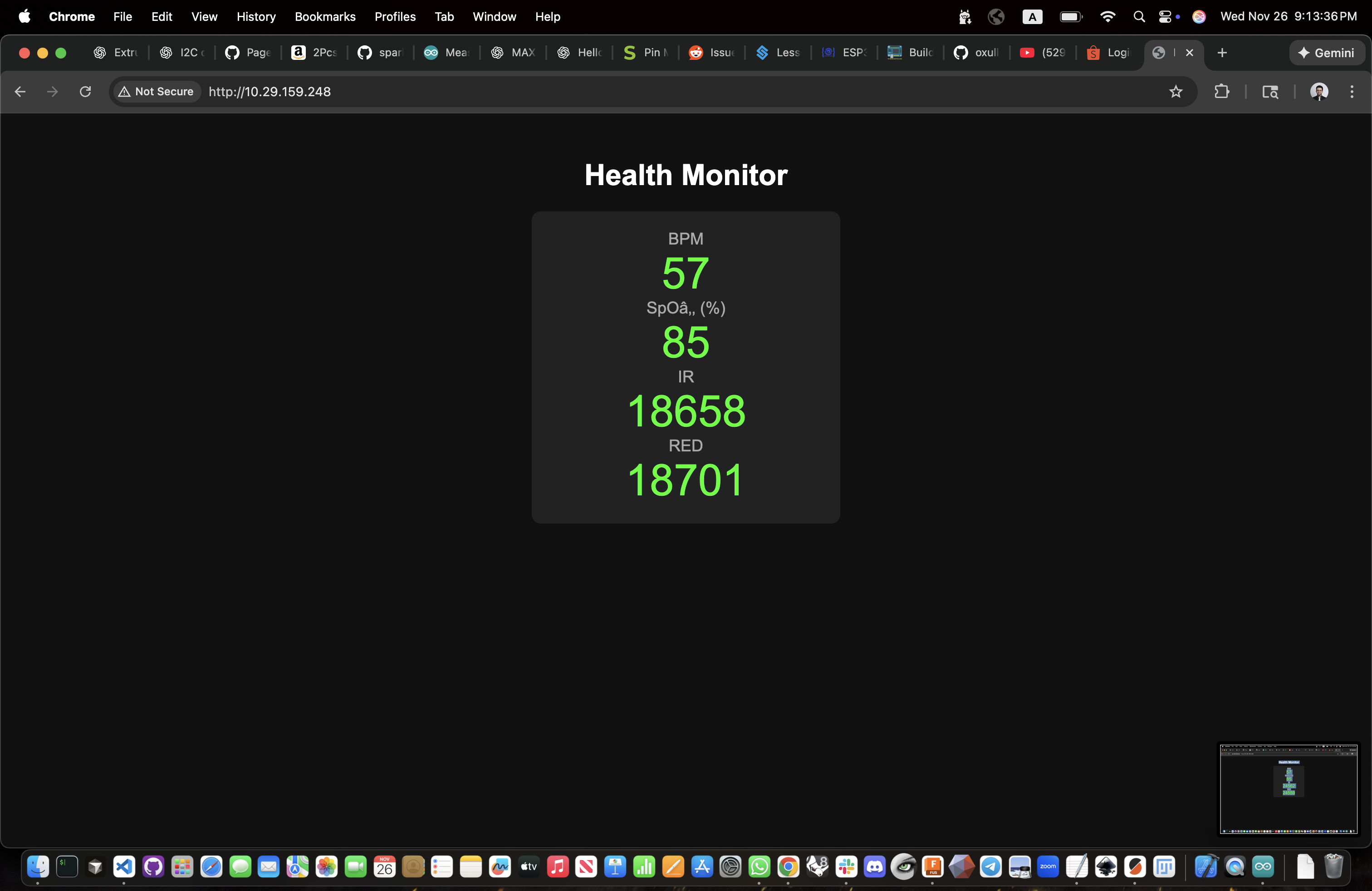 Wi-Fi web interface displaying real-time pulse oximeter readings